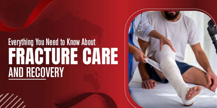 Fracture care and recovery guide